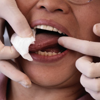 New treatments for oral cancer with chinese herbs