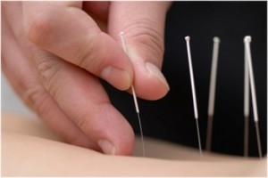 acupuncture at pacherbs.com